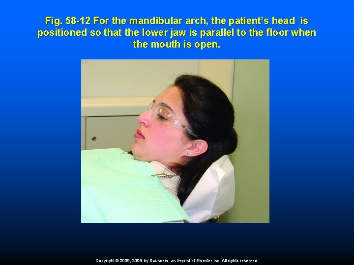 Fig. 58 -12 For the mandibular arch, the patient’s head is positioned so that