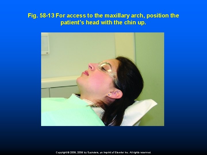 Fig. 58 -13 For access to the maxillary arch, position the patient’s head with