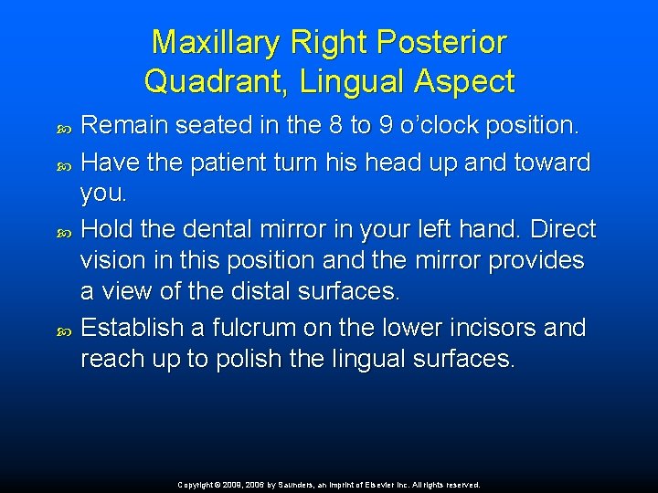 Maxillary Right Posterior Quadrant, Lingual Aspect Remain seated in the 8 to 9 o’clock