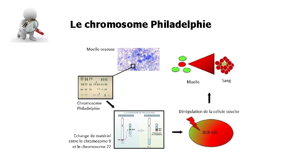 Le chromosome Philadelphie 