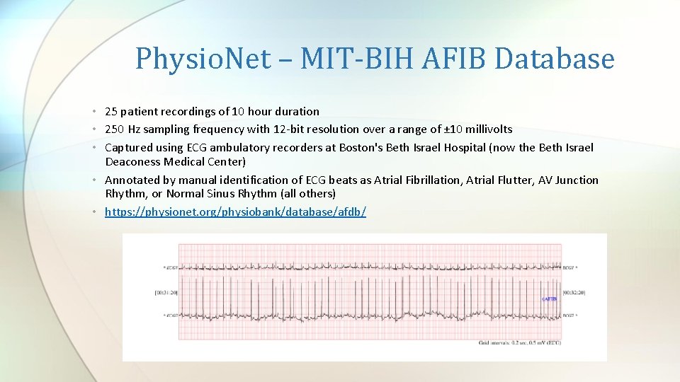 Physio. Net – MIT-BIH AFIB Database • 25 patient recordings of 10 hour duration Physio. Net – MIT-BIH AFIB Database • 25 patient recordings of 10 hour duration