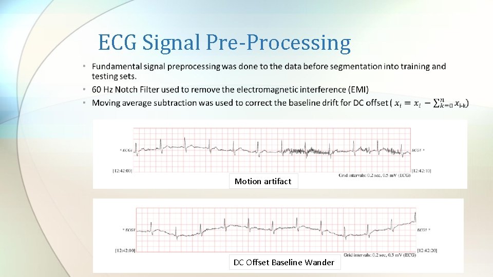 ECG Signal Pre-Processing Motion artifact DC Offset Baseline Wander 