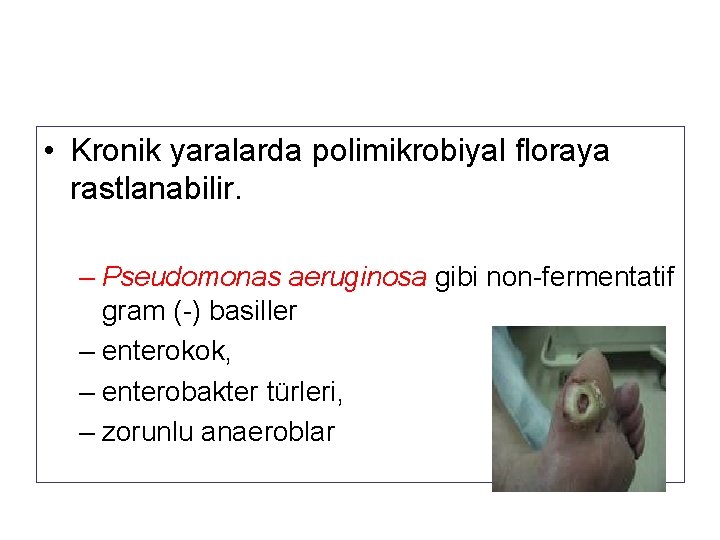  • Kronik yaralarda polimikrobiyal floraya rastlanabilir. – Pseudomonas aeruginosa gibi non-fermentatif gram (-)