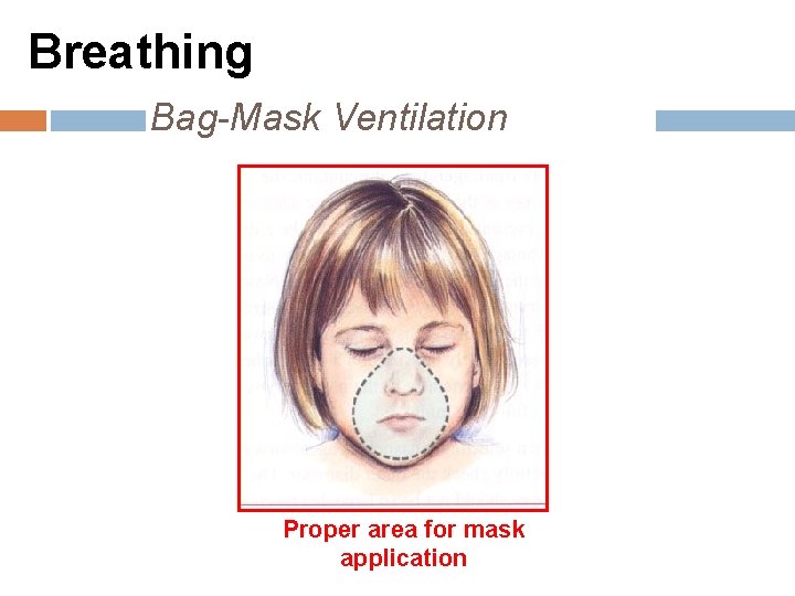 Breathing Bag-Mask Ventilation Proper area for mask application 
