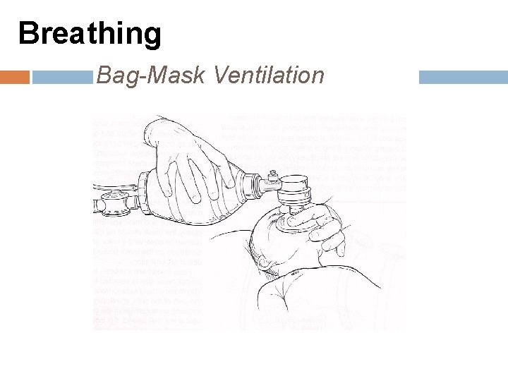 Breathing Bag-Mask Ventilation 