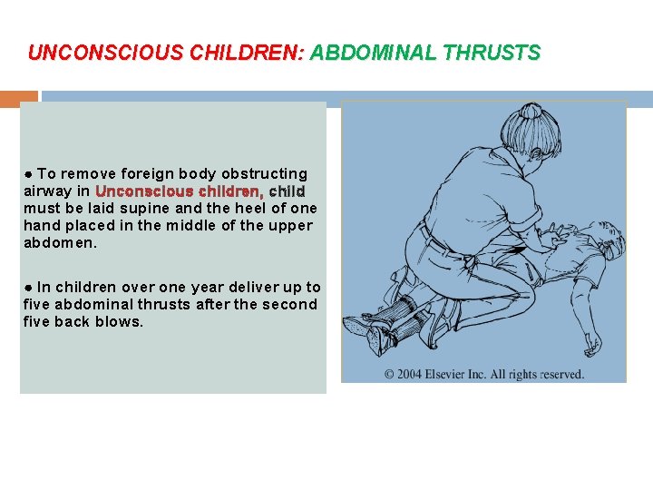 UNCONSCIOUS CHILDREN: ABDOMINAL THRUSTS ● To remove foreign body obstructing airway in Unconscious children,