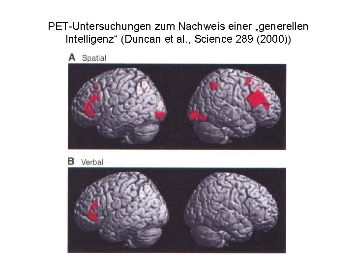 PET-Untersuchungen zum Nachweis einer „generellen Intelligenz“ (Duncan et al. , Science 289 (2000)) 