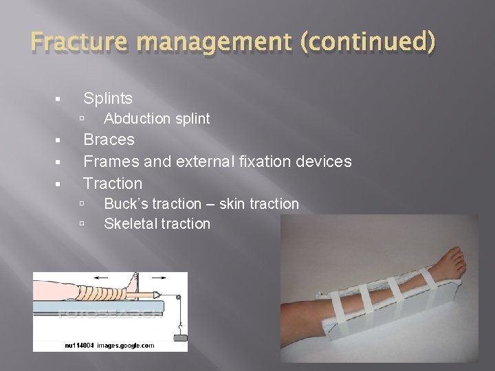 Fracture management (continued) § Splints § § § Abduction splint Braces Frames and external
