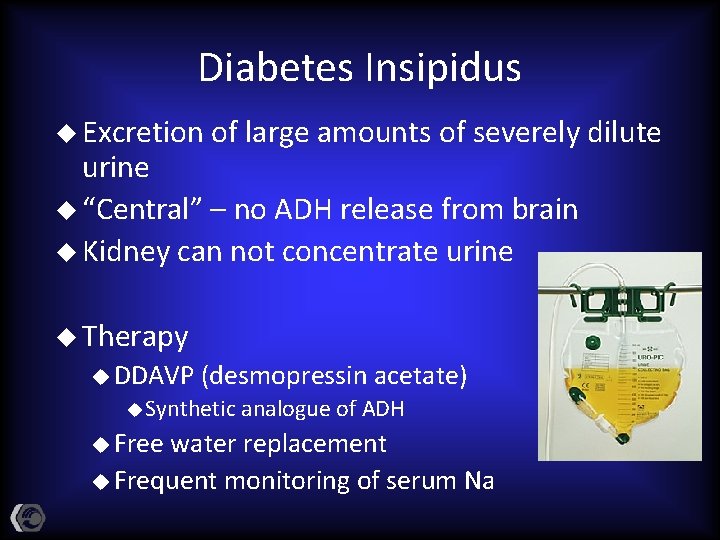 Diabetes Insipidus u Excretion of large amounts of severely dilute urine u “Central” –