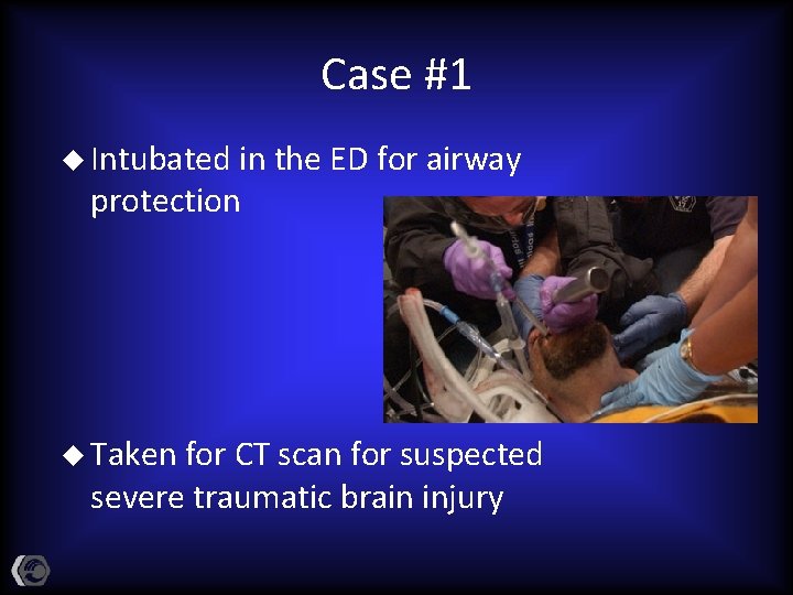 Case #1 u Intubated in the ED for airway protection u Taken for CT