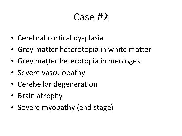Case #2 • • Cerebral cortical dysplasia Grey matter heterotopia in white matter Grey
