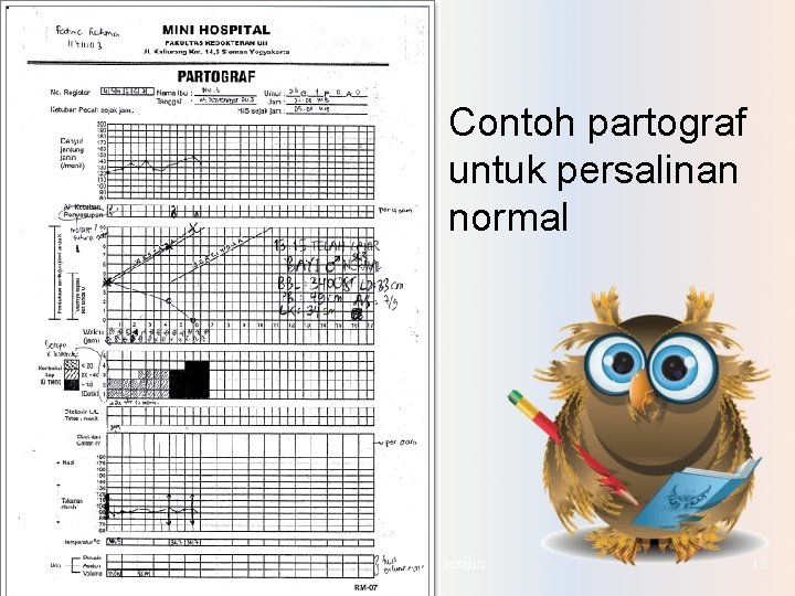 § Contoh partograf untuk persalinan normal Askeb Bersalin 18 