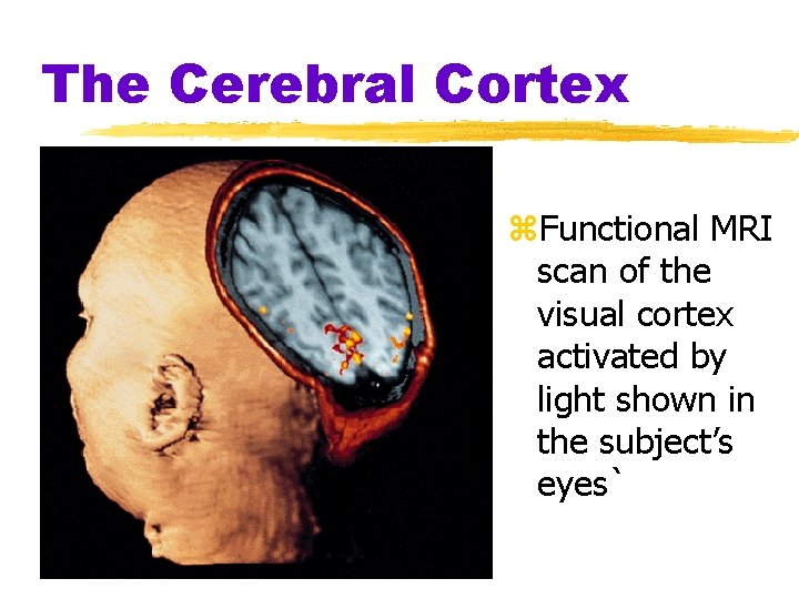 The Cerebral Cortex z. Functional MRI scan of the visual cortex activated by light