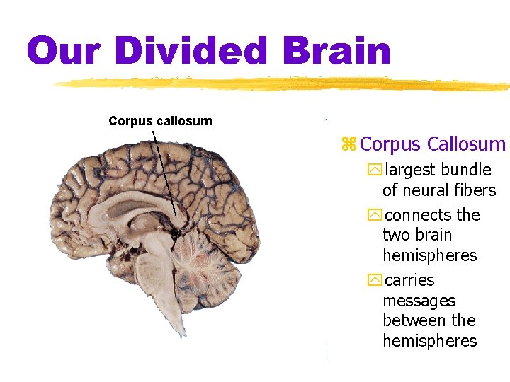 Our Divided Brain Corpus callosum z Corpus Callosum ylargest bundle of neural fibers yconnects