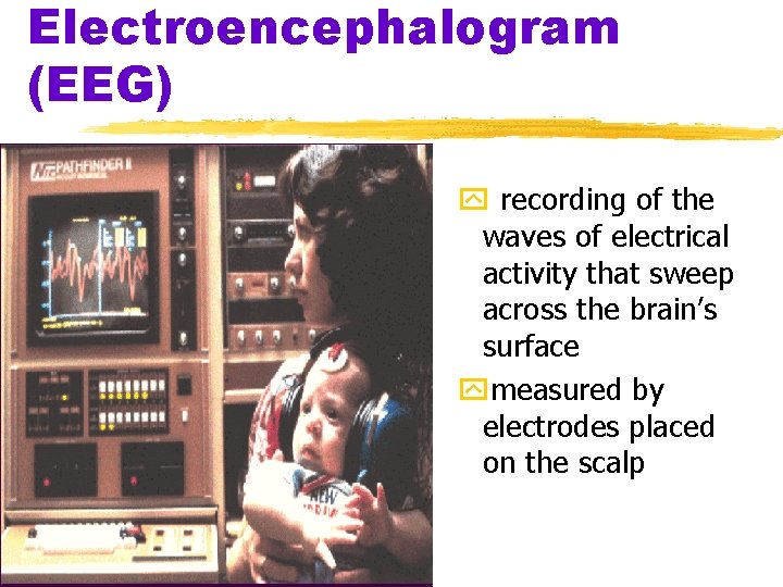 Electroencephalogram (EEG) y recording of the waves of electrical activity that sweep across the