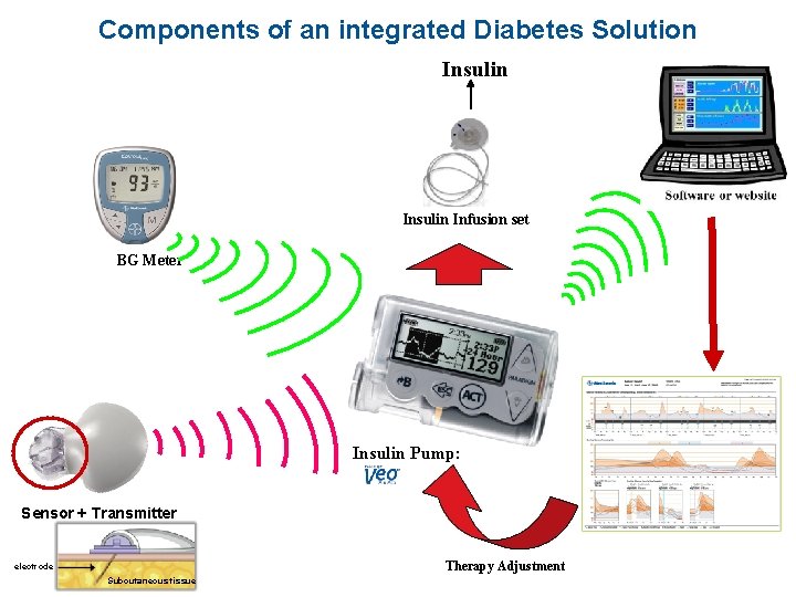 Components of an integrated Diabetes Solution Insulin Infusion set BG Meter Insulin Pump: Sensor