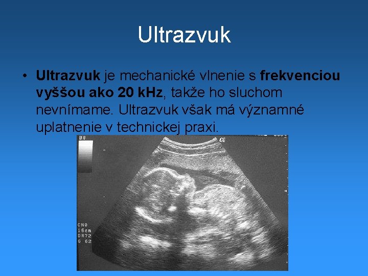 Ultrazvuk • Ultrazvuk je mechanické vlnenie s frekvenciou vyššou ako 20 k. Hz, takže