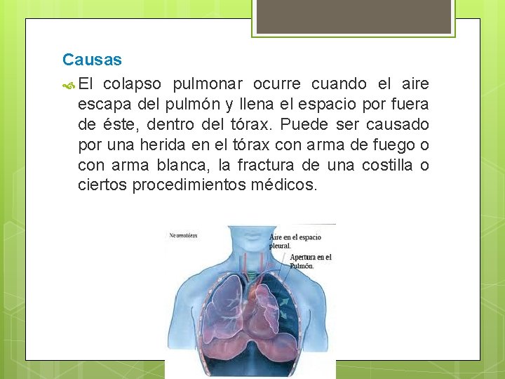 Causas El colapso pulmonar ocurre cuando el aire escapa del pulmón y llena el