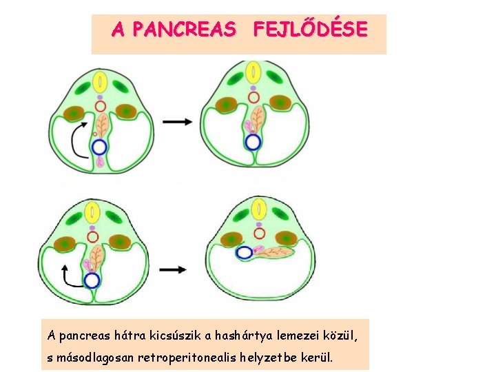 A PANCREAS FEJLŐDÉSE A pancreas hátra kicsúszik a hashártya lemezei közül, s másodlagosan retroperitonealis