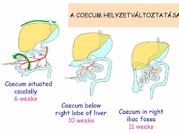 A COECUM HELYZETVÁLTOZTATÁSA 