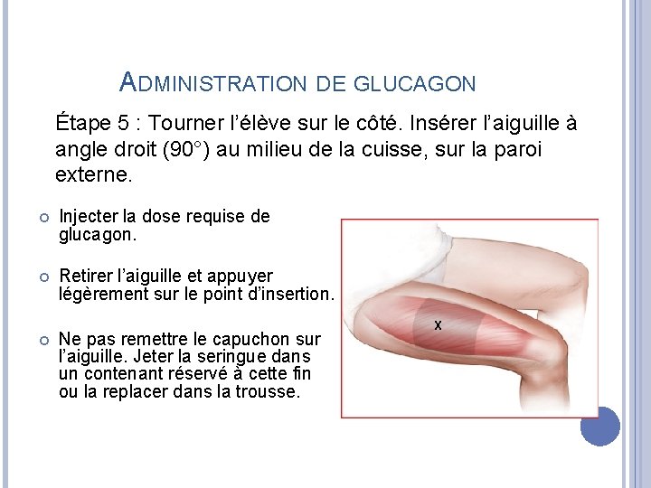ADMINISTRATION DE GLUCAGON Étape 5 : Tourner l’élève sur le côté. Insérer l’aiguille à
