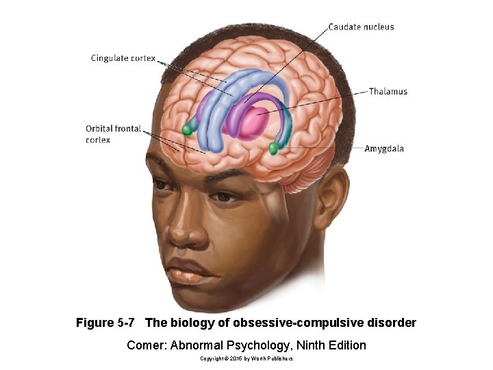 Figure 5 -7 The biology of obsessive-compulsive disorder Comer: Abnormal Psychology, Ninth Edition Copyright