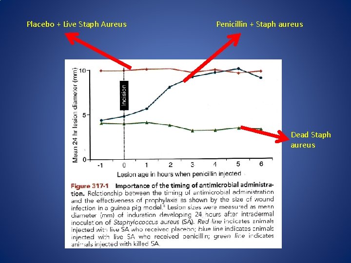 Placebo + Live Staph Aureus Penicillin + Staph aureus Dead Staph aureus 