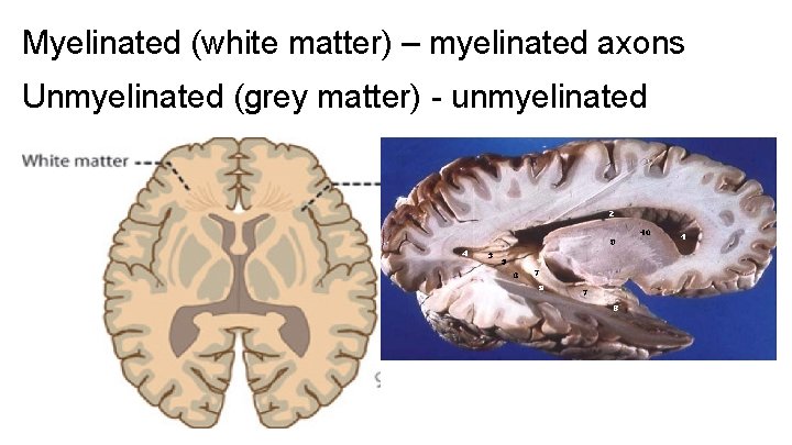 Myelinated (white matter) – myelinated axons Unmyelinated (grey matter) - unmyelinated 