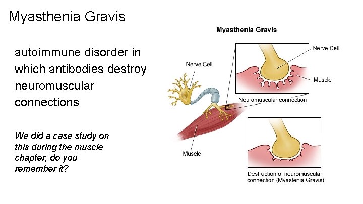 Myasthenia Gravis autoimmune disorder in which antibodies destroy neuromuscular connections We did a case