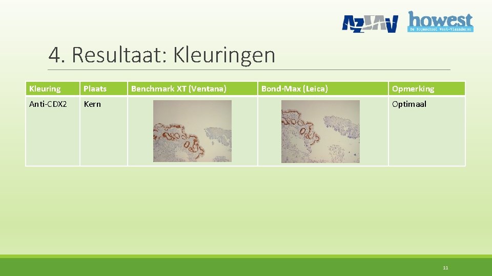 4. Resultaat: Kleuringen Kleuring Plaats Anti-CDX 2 Kern Benchmark XT (Ventana) Bond-Max (Leica) Opmerking