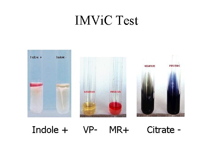 IMVi. C Test Indole + VP- MR+ Citrate -  IMVi. C Test Indole + VP- MR+ Citrate -