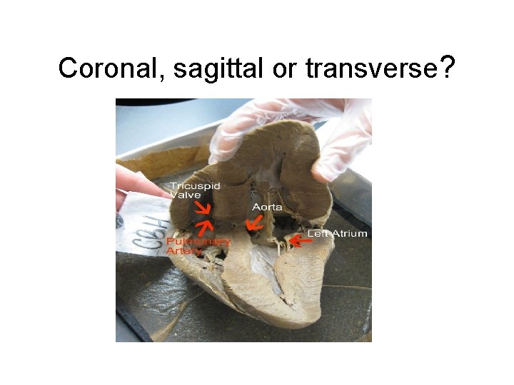 Coronal, sagittal or transverse? 