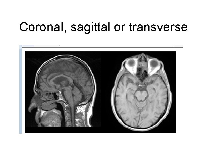 Coronal, sagittal or transverse 