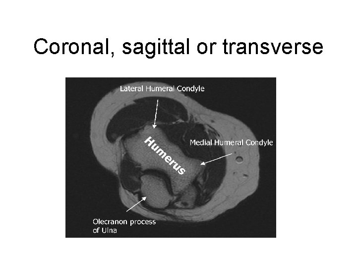 Coronal, sagittal or transverse 