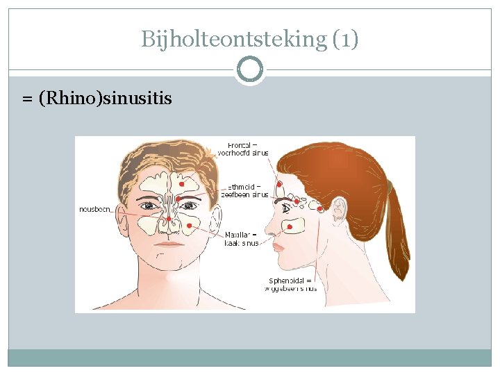 Bijholteontsteking (1) = (Rhino)sinusitis 