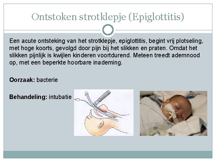 Ontstoken strotklepje (Epiglottitis) Een acute ontsteking van het strotklepje, epiglottitis, begint vrij plotseling, met