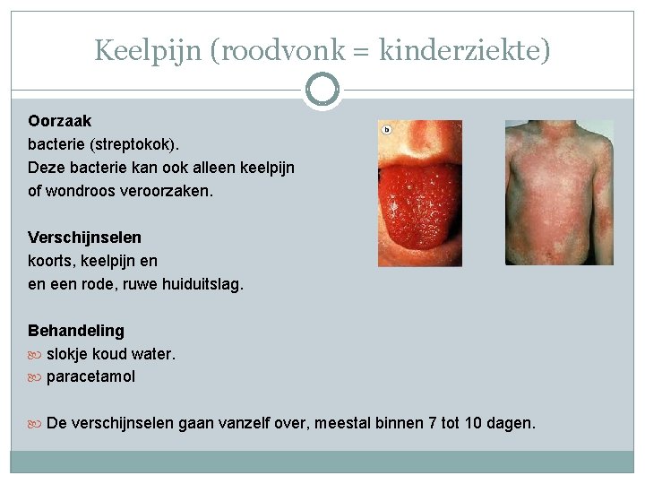 Keelpijn (roodvonk = kinderziekte) Oorzaak bacterie (streptokok). Deze bacterie kan ook alleen keelpijn of