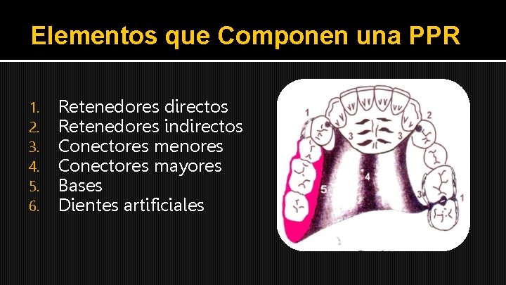 Elementos que Componen una PPR 1. 2. 3. 4. 5. 6. Retenedores directos Retenedores