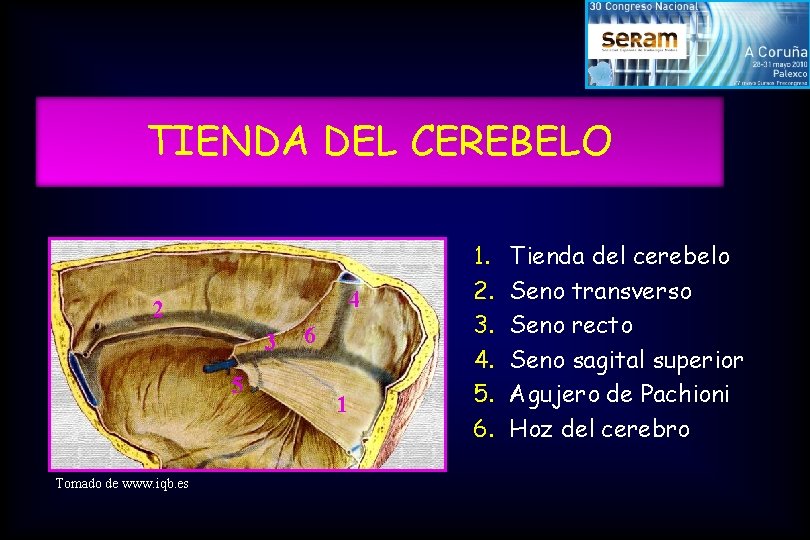 TIENDA DEL CEREBELO 4 2 3 5 Tomado de www. iqb. es 6 1