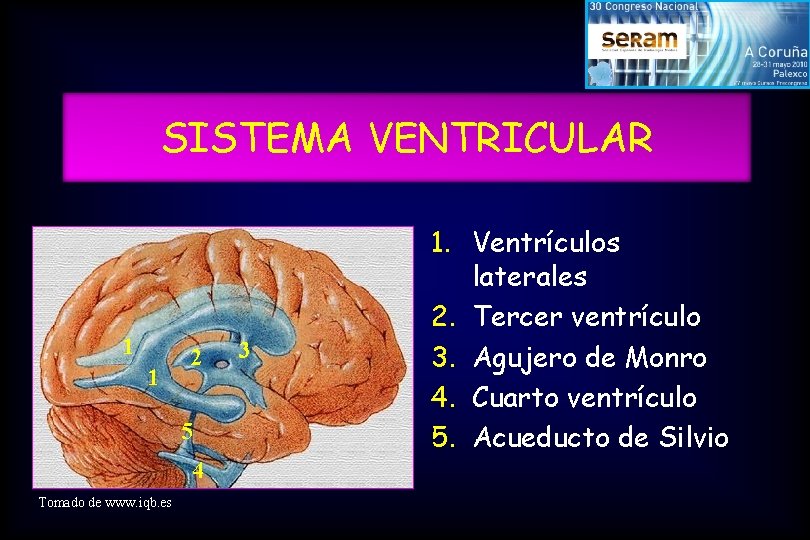 SISTEMA VENTRICULAR 1 1 2 5 4 Tomado de www. iqb. es 3 1.