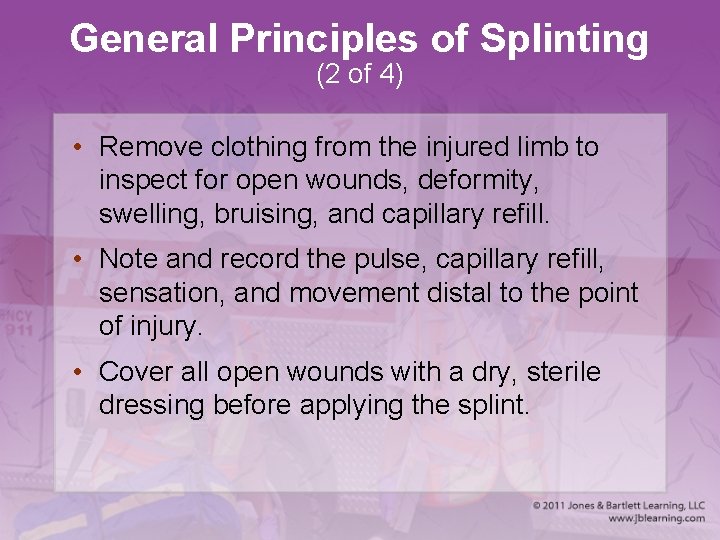 General Principles of Splinting (2 of 4) • Remove clothing from the injured limb