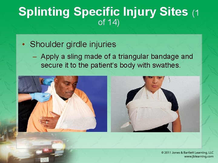 Splinting Specific Injury Sites (1 of 14) • Shoulder girdle injuries – Apply a