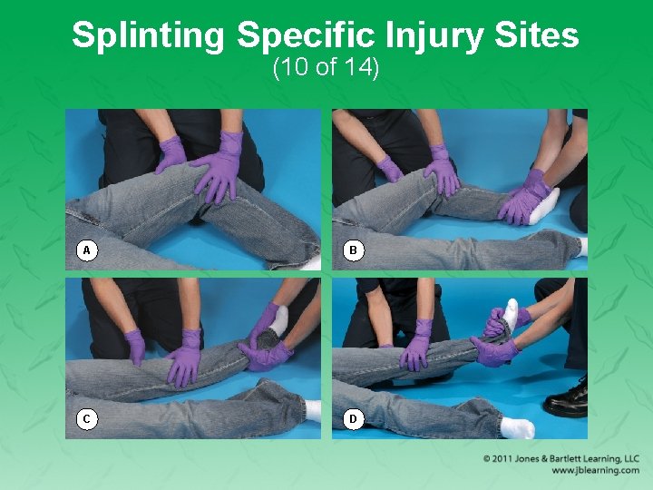 Splinting Specific Injury Sites (10 of 14) A B C D 