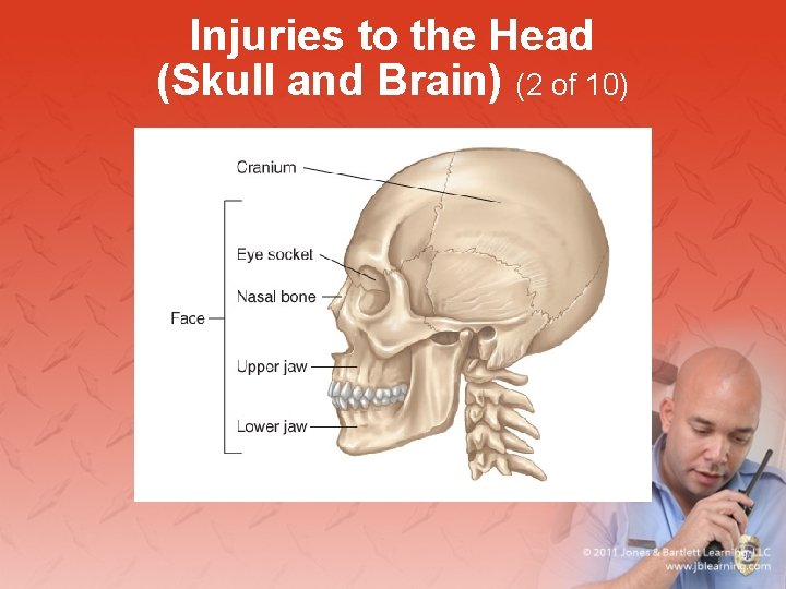 Injuries to the Head (Skull and Brain) (2 of 10) 