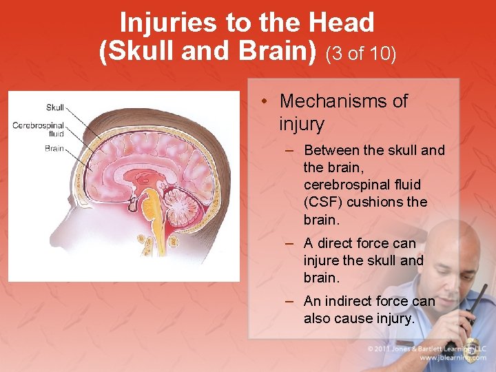 Injuries to the Head (Skull and Brain) (3 of 10) • Mechanisms of injury