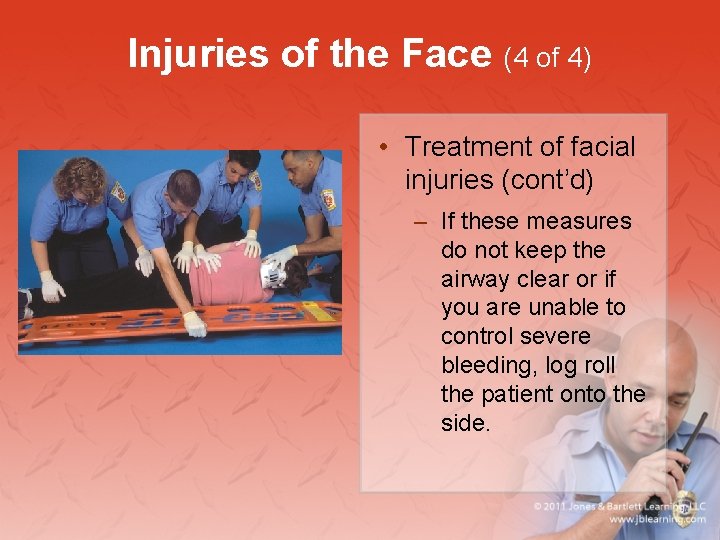 Injuries of the Face (4 of 4) • Treatment of facial injuries (cont’d) –