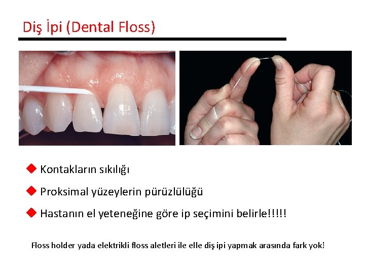 Diş İpi (Dental Floss) u Kontakların sıkılığı u Proksimal yüzeylerin pürüzlülüğü u Hastanın el