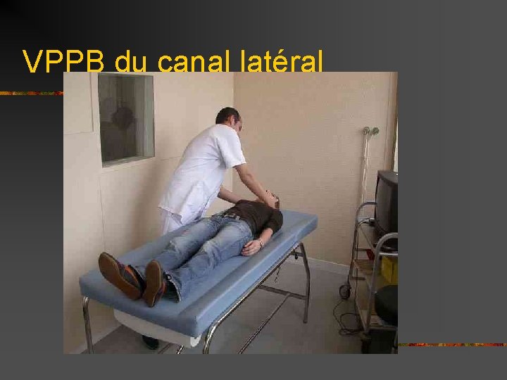 VPPB du canal latéral 