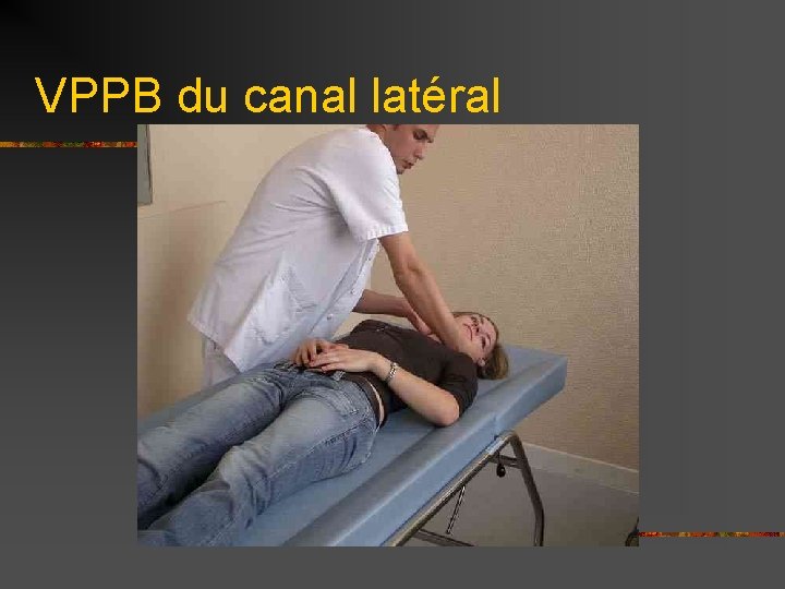 VPPB du canal latéral 