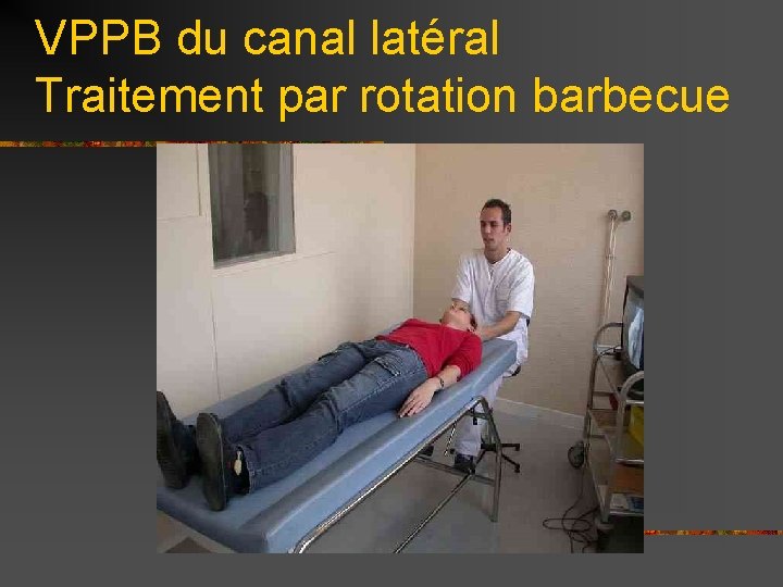VPPB du canal latéral Traitement par rotation barbecue 